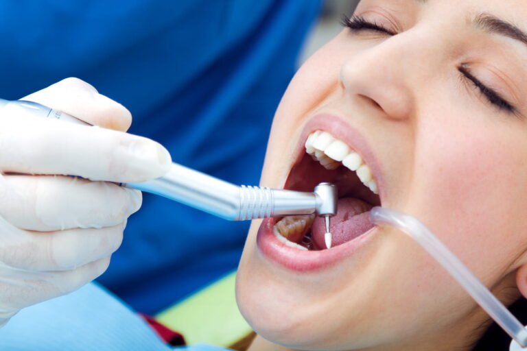 Dental scaling in nagpur at Forever Orthocare the dental clinic in nagpur